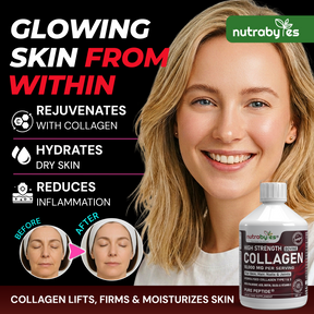 High-Strength Liquid Bovine Collagen Supplement for Women and Men, 10,000 mg Liquid Collagen with Hyaluronic Acid and Vitamin C, 19 Amino Acids,  Collagen Types 1 and 3, Berry Flavoured, Halal & Kosher certified